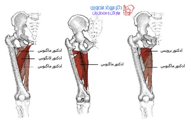 آناتومی اددکتور ماگنوس و لانگوس و برویس