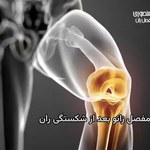 خشکس زانو بعد از شکستگی های استخوان ران را چگونه پیشگیری و درمان کنیم