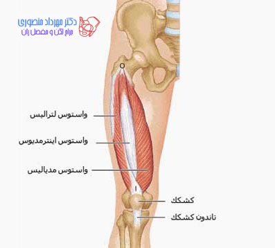 آناتومی عضله چهارسر ران یا کوادری سپس