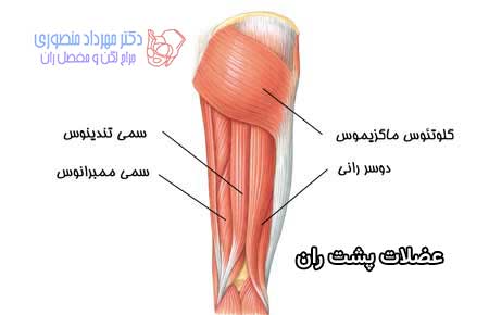 عضلات پشت ران