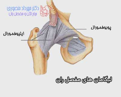 لیگامان های خارج کپسولی مفصل ران