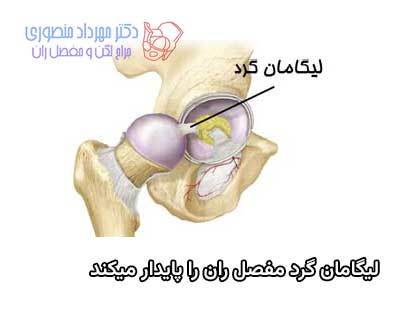 لیگامان گرد در مفصل ران این مفصل را پایدار میکند