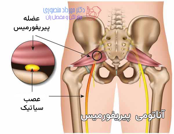 آناتومی عضله پیریفورمیس و عصب سیاتیک