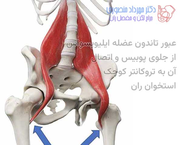 عبور تاندون عضله ایلیوپسواس از جلوی پوبیس و اتصال آن به تروکانتر کوچک استخوان ران