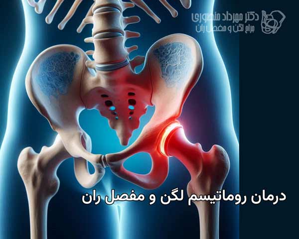 درمان روماتیسم لگن و مفصل ران چگونه است