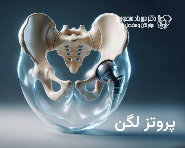 پروتز لگن چه ساختمانی و چه انواعی دارد و در کجا استفاده میشود