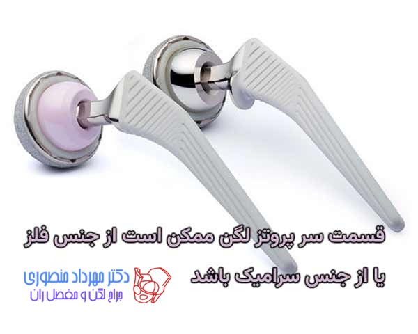 پروتز لگن چیست و چند نوع دارد 7 قسمت سر پروتز لگن ممکن است از جنس فلز یا از جنس سرامیک باشد