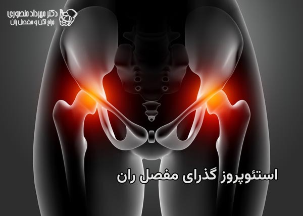 پوکی استخوان گذرای مفصل ران چیست