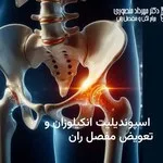 اسپوندیلیت انکیلوزان و جراحی تعویض مفصل