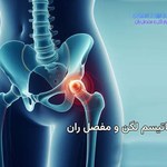 روماتیسم لگن و مفصل ران چیست