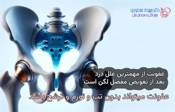 عفونت مفصل مصنوعی لگن، علائم و درمان 5 عفونت اطراف مفصل مصنوعی از مهمترین علل باقیماندن درد بعد از جراحی تعویض مفصل است