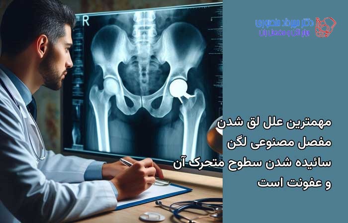 لق و شل شدن مفصل مصنوعی لگن 4 مهمترین علل لقی مفصل مصنوعی کار گذاشته شده در لگن سایش سطوح متحرک آن و عفونت است