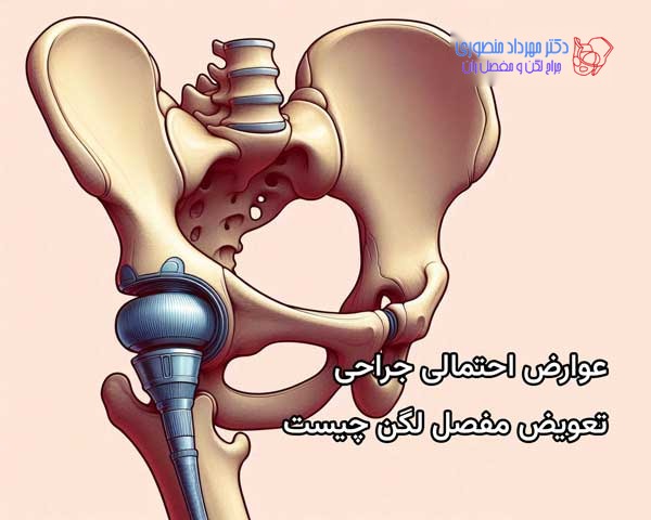 عوارض احتمالی جراحی تعویض مفصل در ناحیه لگن چیست