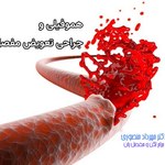 هموفیلی و جراحی تعویض مفصل