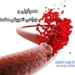هموفیلی و جراحی تعویض مفصل
