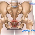 استئیت پوبیس چیست