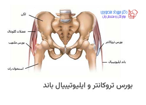 آناتومی بورس تروکانتر و ایلیوتیبیال باند