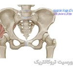 بورسیت تروکانتریک چیست و چگونه درمان میشود
