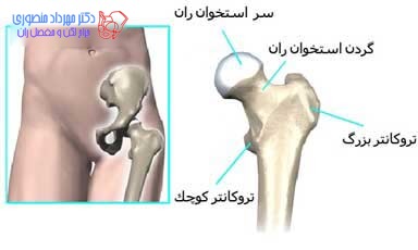 آناتومی لگن و مفصل ران، تفاوت آناتومی لگن زن و لگن مرد 11 عکس آناتومی لگن. سر استخوان ران و تروکانتر بزرگ و کوچک ران