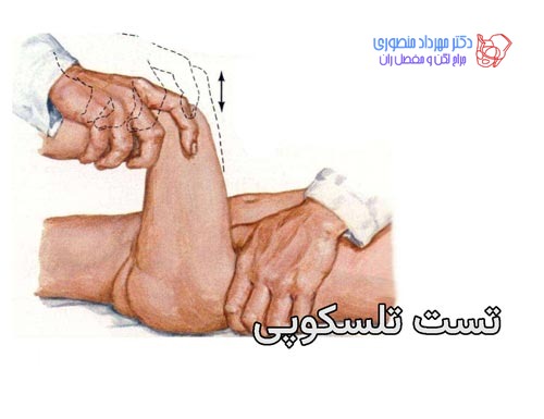 عکس دررفتگی لگن نوزاد. تست تلسکوپی برای تشخیص دررفتگی مادرزادی لگن و مفصل ران در کودکان