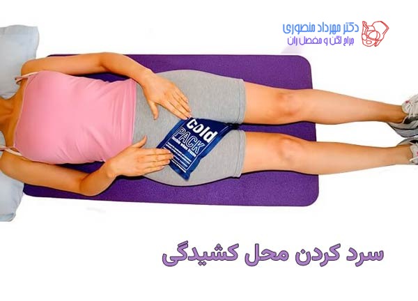درمان کشیدگی کشاله ران در منزل