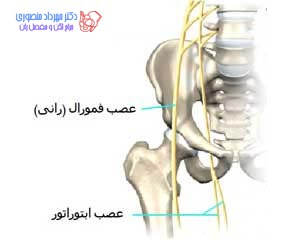 عصب ابتوراتور و رانی