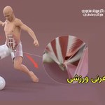 هرنی یا فتق ورزشی چیست