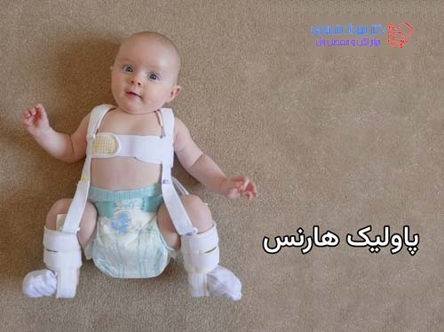 استفاده از کمربند دررفتگی لگن نوزاد