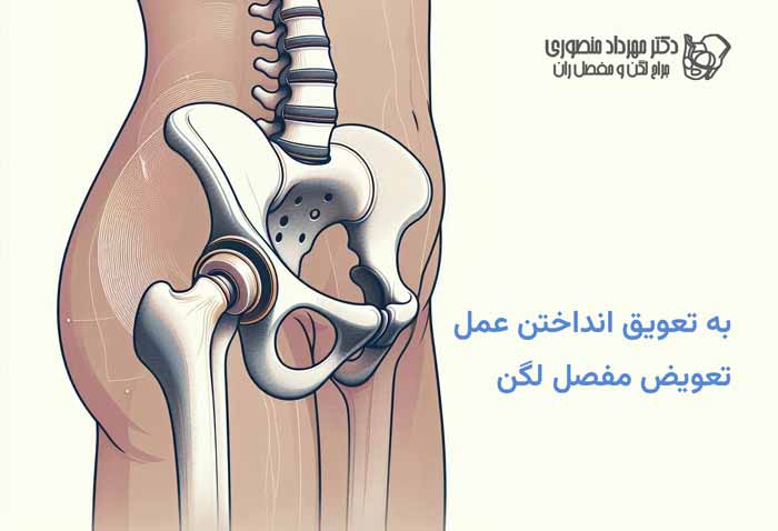 به تعویق انداختن عمل تعویض مفصل