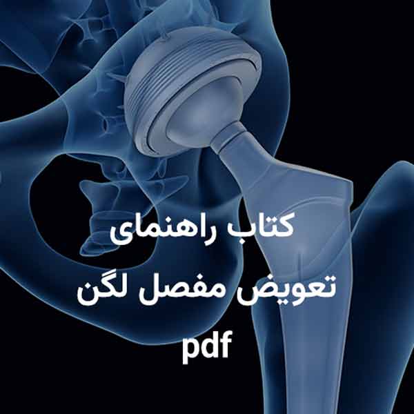 تعویض مفصل لگن (توتال هیپ) چیست؟ راهنمای کامل جراحی تعویض مفصل ران 3 راهنمای تعویض مفصل ران