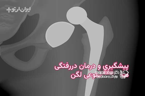 دررفتگی مفصل مصنوعی لگن