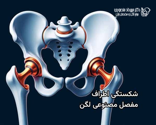شکستگی اطراف مفصل مصنوعی