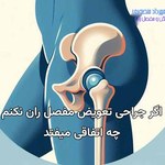 اگر تعویض مفصل ران نکنم