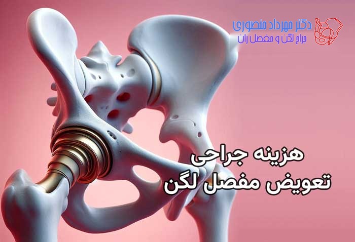 هزینه جراحی تعویض مفصل لگن