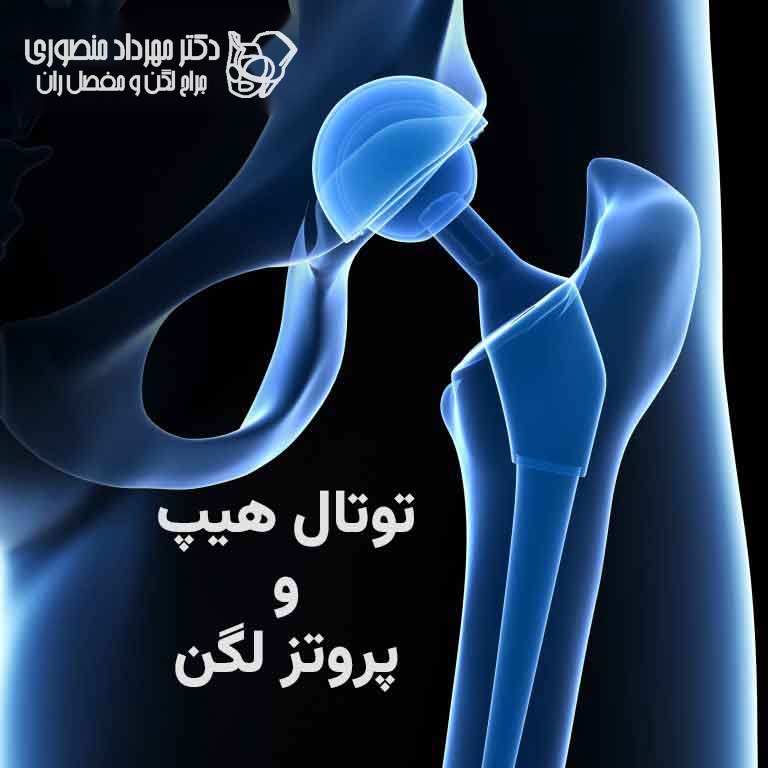 توتال هیپ و پروتز لگن چیست