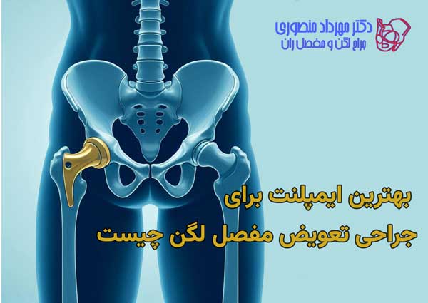 best artificial hip implant 1
