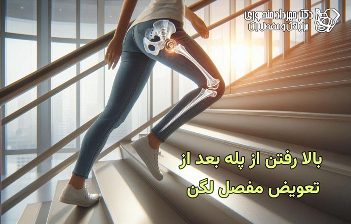climb stairs after hip replacement 1
