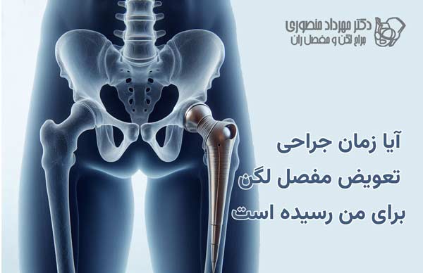 hip replacement decision 1