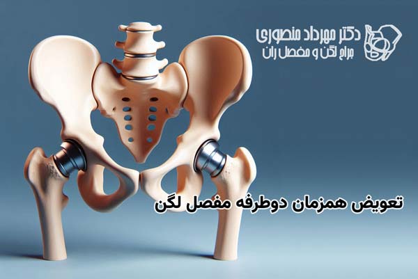 one stage bilateral total hip replacement featured