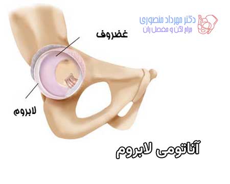 آناتومی لگن و مفصل ران، تفاوت آناتومی لگن زن و لگن مرد 16 آناتومی لابروم مفصل ران