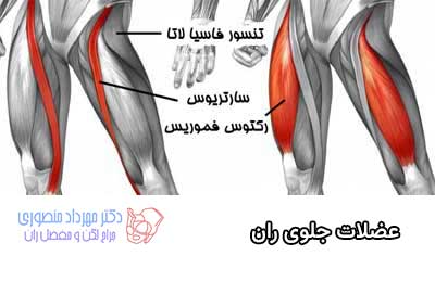 آناتومی لگن و مفصل ران، تفاوت آناتومی لگن زن و لگن مرد 24 عضلات جلوی ران