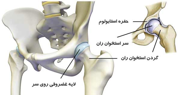 تعویض مفصل لگن (توتال هیپ) چیست؟ راهنمای کامل جراحی تعویض مفصل ران 10 آناتومی سر و گردن استخوان ران و حفره استابولوم
