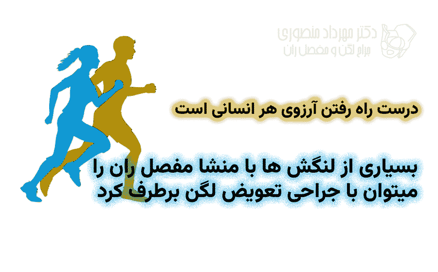 تعویض مفصل لگن (توتال هیپ) چیست؟ راهنمای کامل جراحی تعویض مفصل ران 8 بسیاری از لنگش ها با منشا مفصل ران را میتوان با جراحی تعویض مفصل لگن برطرف کرد
