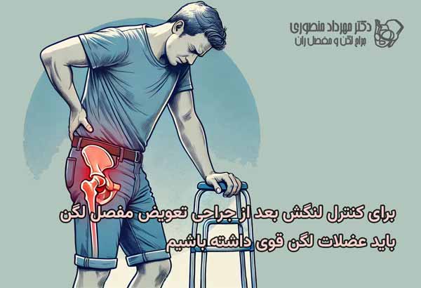 علت لنگش بعد از عمل تعویض مفصل لگن چیست 4 ضعف عضلات لگن و لنگش بعد از عمل تعویض مفصل