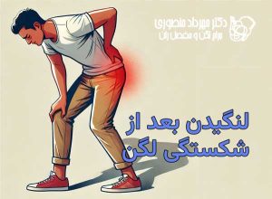 لنگیدن بعد از شکستگی لگن