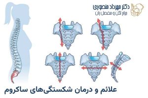 شکستگی ساکروم. تشخیص و درمان