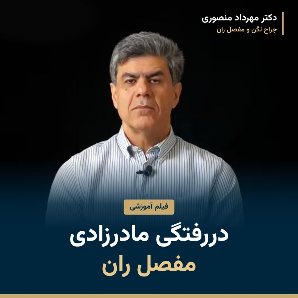 دررفتگی مادرزادی مفصل ران در بزرگسالان